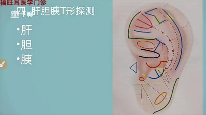 張福旺精講耳穴診斷班百度網(wǎng)盤