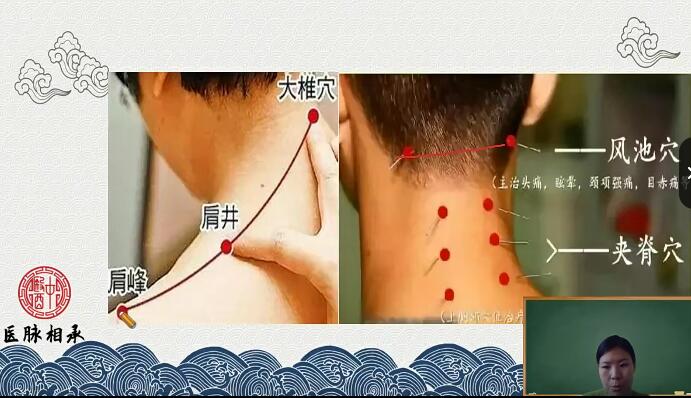 醫(yī)脈相承王瑤十五組針灸特效方-中醫(yī)特效針灸教學(xué)百度網(wǎng)盤